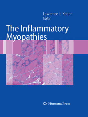 cover image of The Inflammatory Myopathies